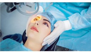 LASIK Eye Surgery
